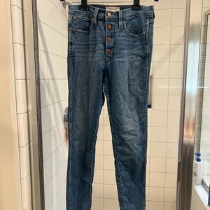 Madewell High Rise Blue Jeans with Button Fly